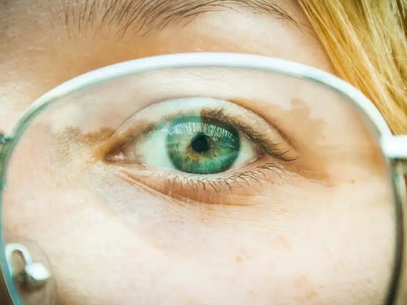 Close-up photography of the eye
